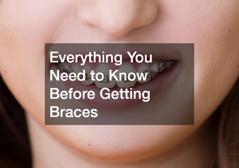 Everything You Need to Know Before Getting Braces - Cavity Free Living